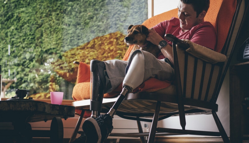 A young man is sitting in an armchair patting a dog. He is wearing prosthetic lower legs.